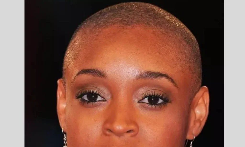 Bald and Beautiful